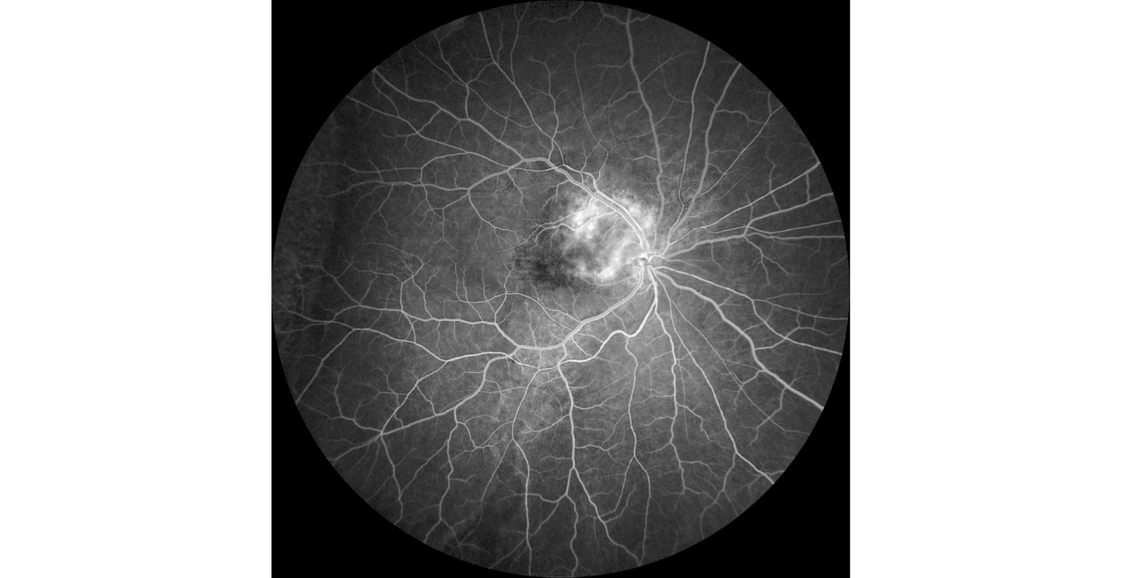 Exames Especializados
